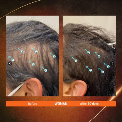 Abera Hair Growth Serum for Thinning Hair, Scalp Serum, 1.69oz