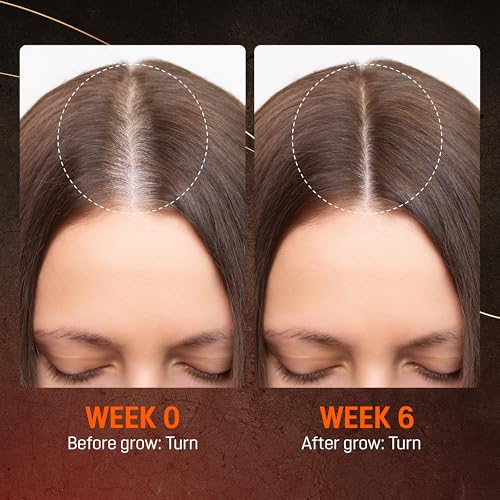 Abera Hair Growth Serum for Thinning Hair, Scalp Serum, 1.69oz