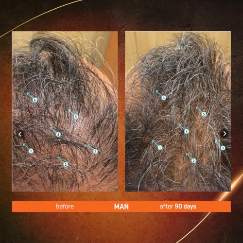 Abera Hair Growth Serum for Thinning Hair, Scalp Serum, 1.69oz