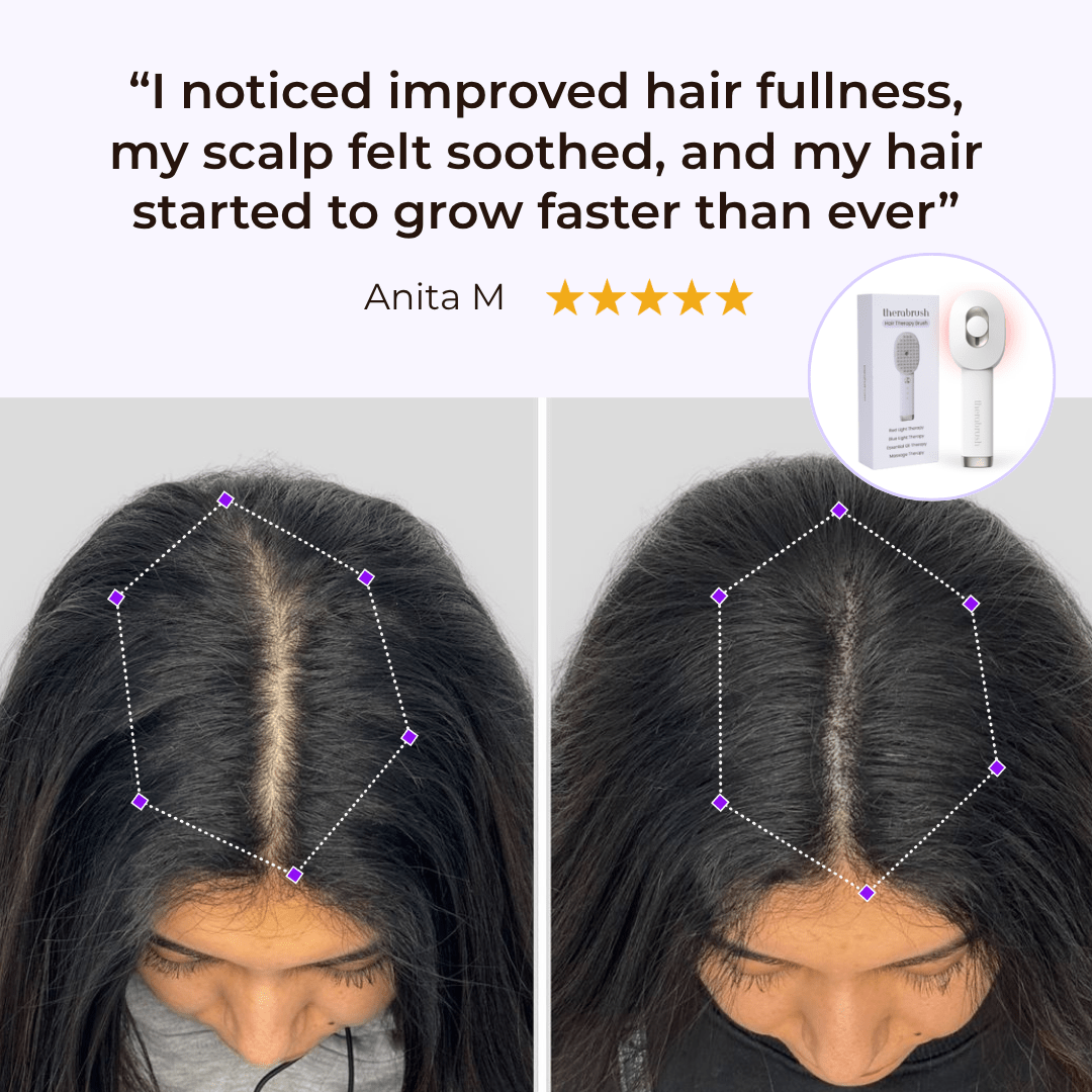 TheraBrush® 4-in-1 Hair Revival Brush – Advanced Scalp & Hair Growth Therapy