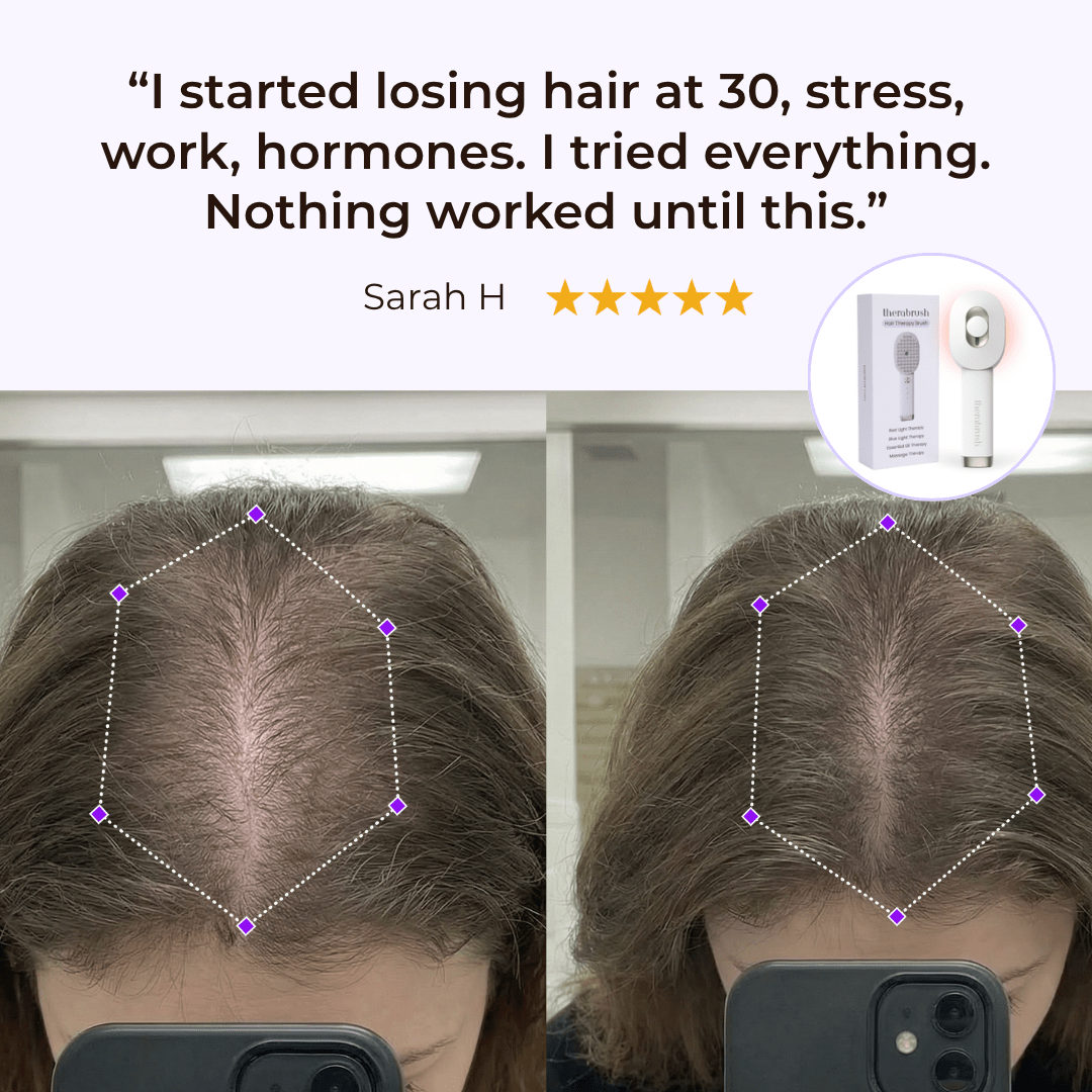 TheraBrush® 4-in-1 Hair Revival Brush – Advanced Scalp & Hair Growth Therapy
